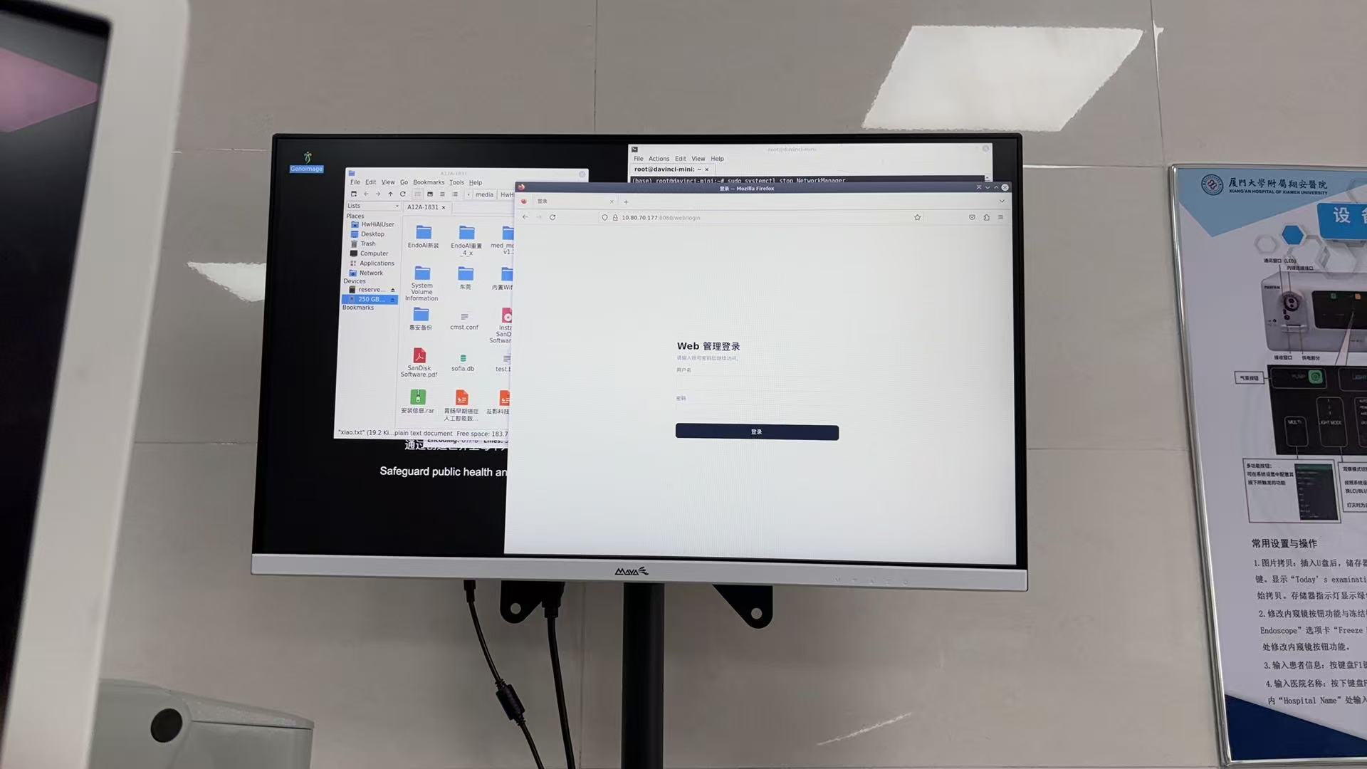 Screening system