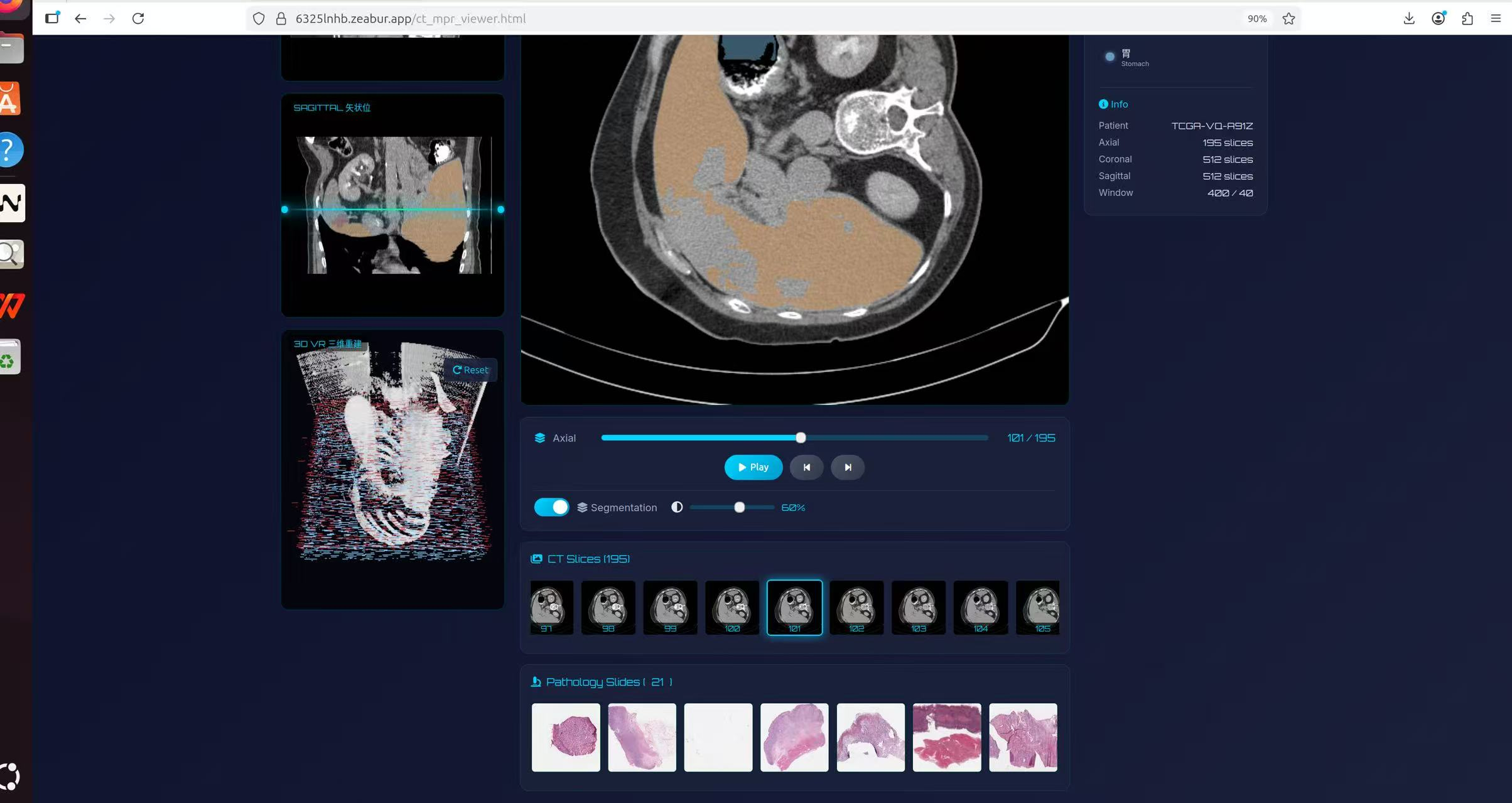 Medical Imaging 2